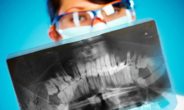 Рентген челюсти и височно-нижнечелюстного сустава у детей и взрослых