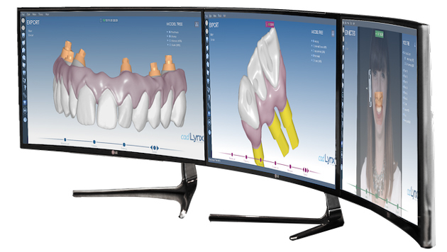 Компьютерная томография зубов и челюсти, что такое 3d-томография
