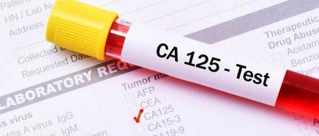 Что означает СА 125 в анализе крови: норма, расшифровка, как правильно сдавать