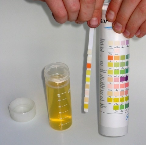 Тест-полоски для определения ацетона в моче у ребенка или взрослого, инструкция по применению