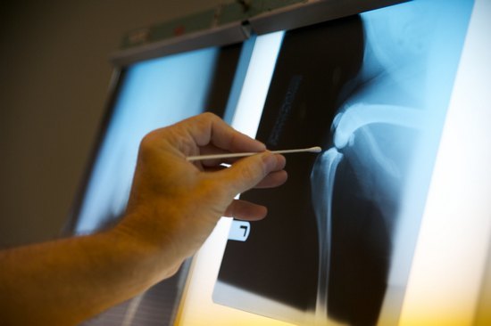 Как часто можно делать рентген (рентгеновские снимки), сколько раз в год