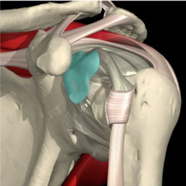 Артроскопия плечевого сустава: что это такое, отзывы