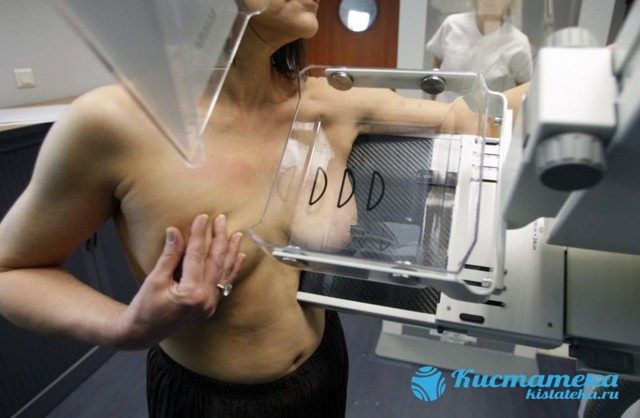 УЗИ молочных желез: что показывает исследование грудной железы, как делают маммографию груди