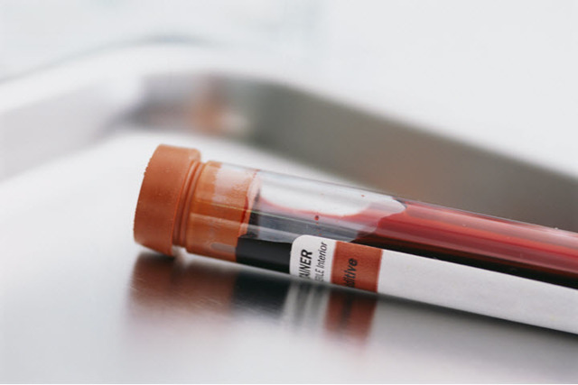 neu в анализе крови: что это такое, причины повышения уровня
