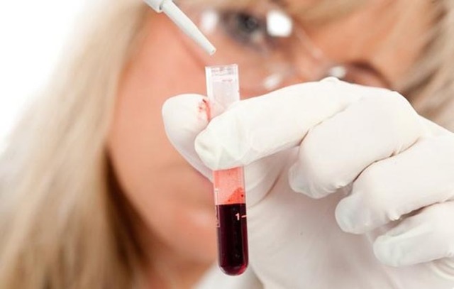 plt в анализе крови: что это такое, расшифровка, норма у женщин, почему повышен