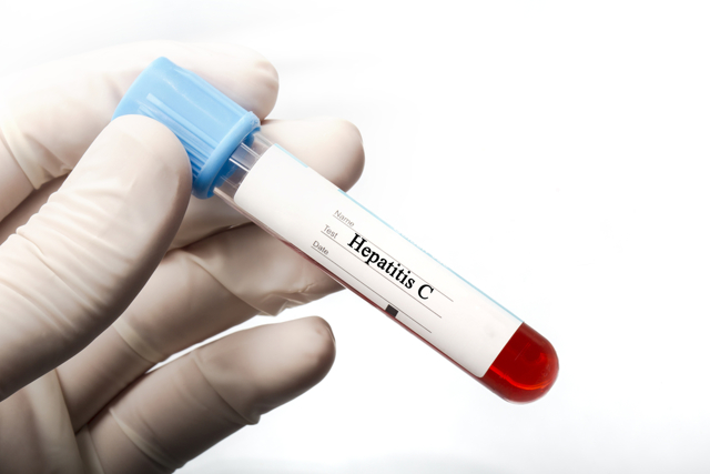 Анализ крови на hcv anti total: что это такое, расшифровка, подготовка к диагностике