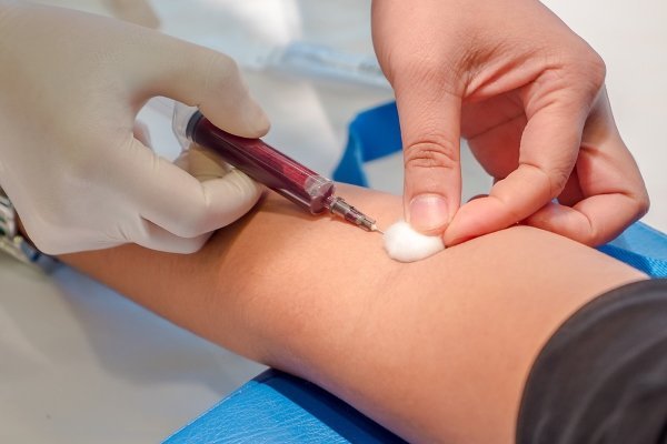 Повышенные тромбоциты в крови у женщин, мужчин: причины повышения, как снизить высокий уровень