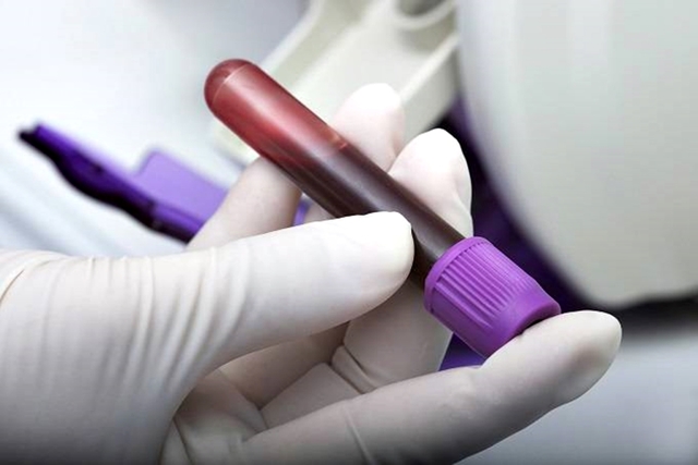 rpr в анализе крови: что это такое, показания, диагностика, расшифровка показателей