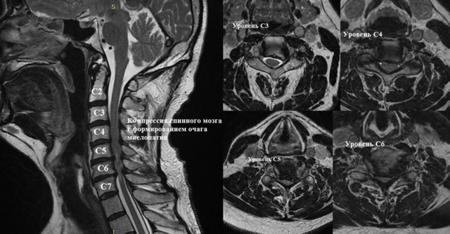 МРТ шеи и мягких тканей шейного отдела: что показывает, как делают, отзывы