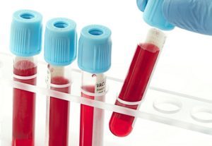 Нейтрофилы в анализе крови: что это такое, за что отвечают, норма, как поднять уровень