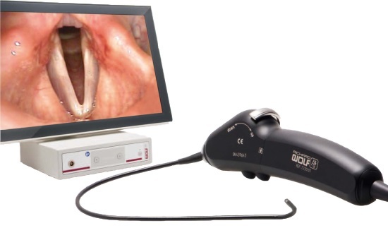 Эндоскопия горла: видео, как проводят эндоскопическое исследование гортани, показания