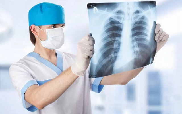Рентген легких: что показывает рентгенография, как часто можно делать рентогеноскопию