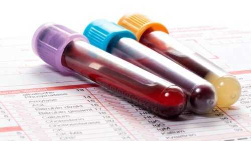 Как обозначается сахар в анализе крови, обозначение ретикулоцитов, гемоглобина, лейкоцитов и тромбоцитов