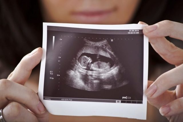 УЗИ на 5 неделе беременности: фото, можно ли делать, что покажет, размеры плода