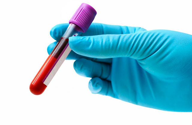 Анализ крови на лямблии и гельминты: расшифровка, что это такое, как сдавать