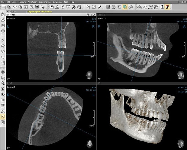 Конусно-лучевая компьютерная томография челюстно-лицевой области в стоматологии