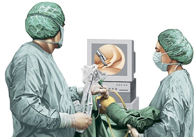 Артроскопия плечевого сустава: что это такое, отзывы