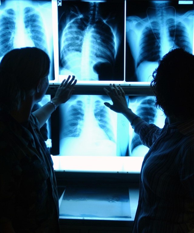 Вреден ли рентген: чем он опасен для здоровья, вред для организма