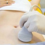 Беременность после лапароскопии: когда можно беременеть, отзывы
