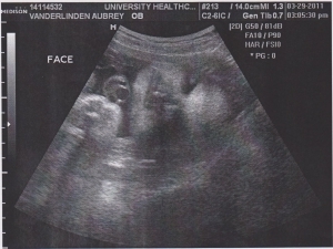 Как выглядит ребенок в 30 недель беременности на УЗИ: фото, что смотрят
