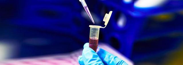 hbsag в анализе крови: что это означает, расшифровка отрицательного антигена
