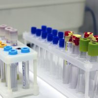 Клинический анализ крови в Хеликс: как сдавать, подготовка к биохимическому исследованию