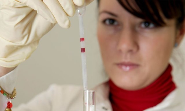 Анализ крови на ревмопробы: что это такое, как сдавать, расшифровка и норма