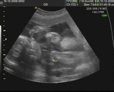 Можно ли определить пол ребенка по УЗИ при беременности в 12 недель