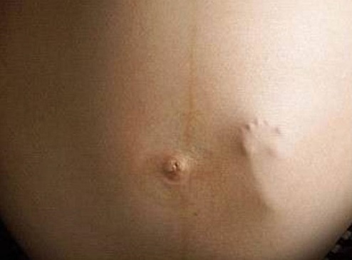 3Д УЗИ при беременности в 20 недель, фото и видео плода