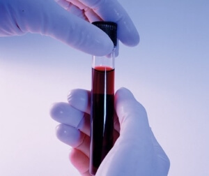 АЛТ в анализе крови: что это такое, норма показателей у женщин и мужчин