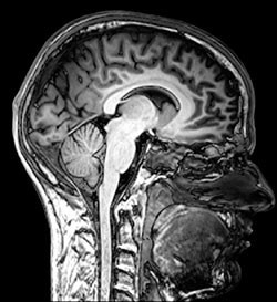 В чем разница МРТ с контрастом и без (головного мозга, гипофиза)