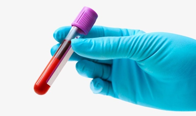 АЛТ в анализе крови: что это такое, норма показателей у женщин и мужчин