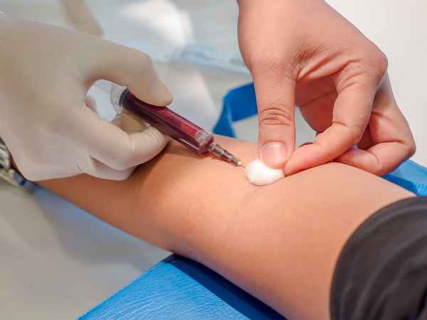 Норма кальция в крови у женщин и мужчин: как сдавать анализ, причины низкого уровня