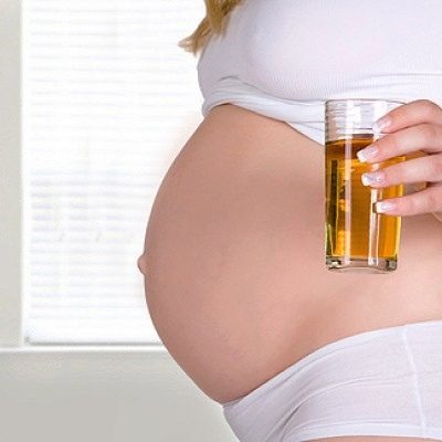 Аморфные фосфаты в моче при беременности: причины появления солей, диагностика