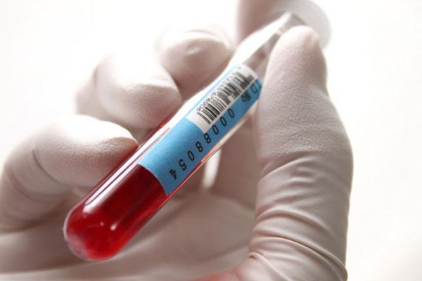 Анализ крови на ПСА: что означает, расшифровка, как понизить уровень psa народными средствами