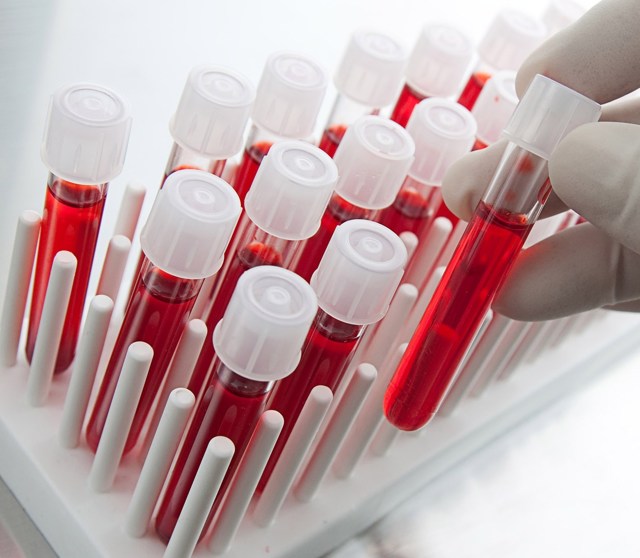 hgb в анализе крови: что это такое, расшифровка, норма у женщин и мужчин