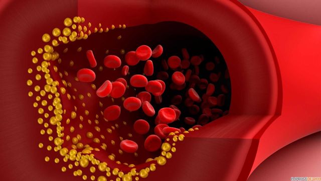 Плохой и хороший холестерин в анализе крови: как снизить или поднять, нормы содержания