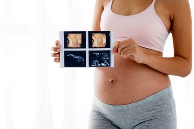 3Д УЗИ при беременности, фото и видео плода при трехмерном исследовании