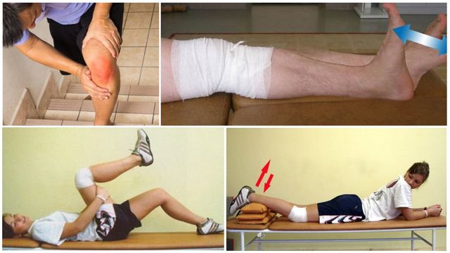 Артроскопия коленного сустава: реабилитация после операции, восстановление, ЛФК