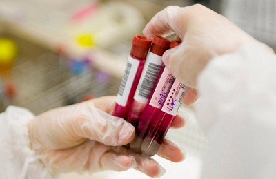 rdw в анализе крови: что это такое, почему бывает повышен, расшифровка и норма у женщин