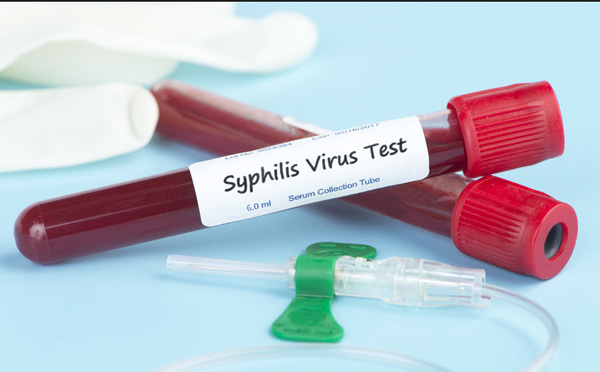 Анализ крови на сифилис: откуда берут, как называется, расшифровка общей диагностики