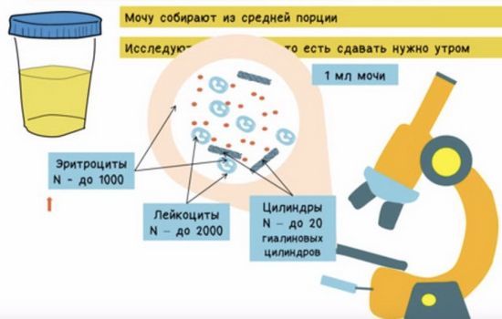 Анализ мочи по Нечипоренко: норма, расшифровка результатов, почему бывают повышены лейкоциты и эритроциты