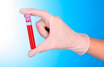 Норма лейкоцитов в крови у мужчин: расшифровка показателей wbc, причины изменения уровня