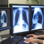 Что лучше – МРТ или КТ: какое обследование безопаснее, показания к компьютерной томографии