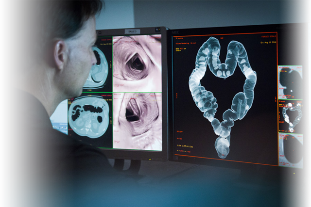 Компьютерная томография кишечника: что показывает, что это такое