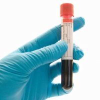 АЛТ и АСТ в анализе крови: расшифровка и норма, причины повышения уровня