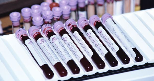 Иммуноферментный анализ крови: что это такое, расшифровка исследования методом ИФА на паразитов