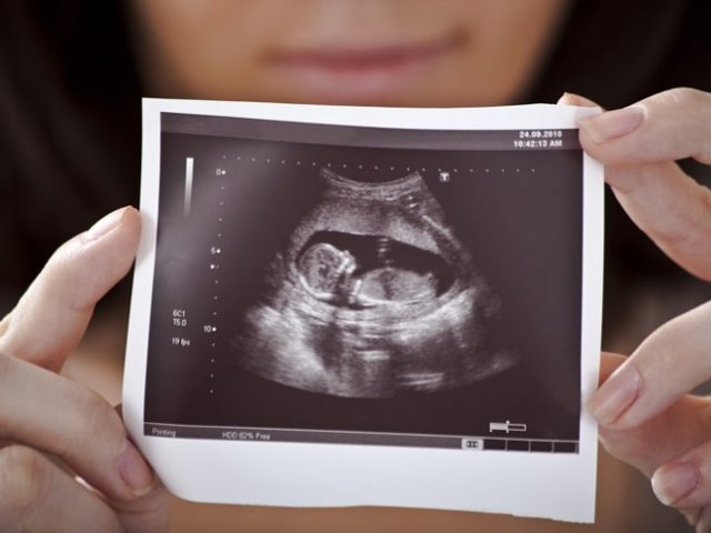 Когда делают первое УЗИ при беременности: во сколько недель, на каком сроке