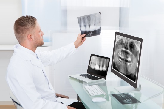 Цифровой рентген: суть метода и показания, техника проведения рентгенографии