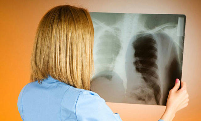 Рентген ребенку: вредно ли, чем он опасен, возможный вред